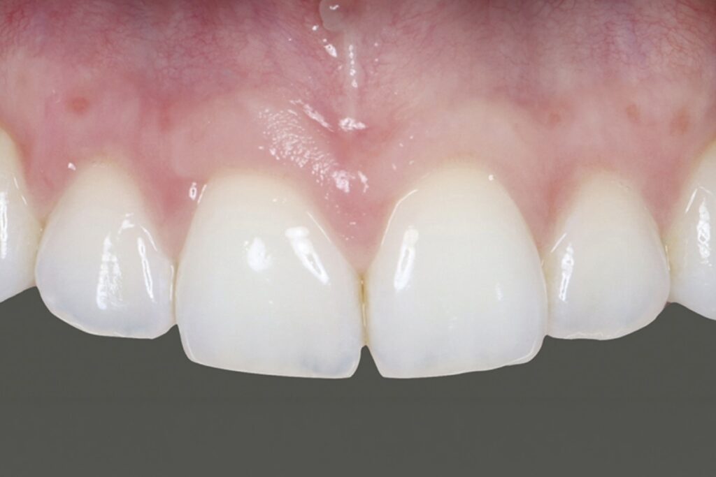 Villaespaceparo_apres