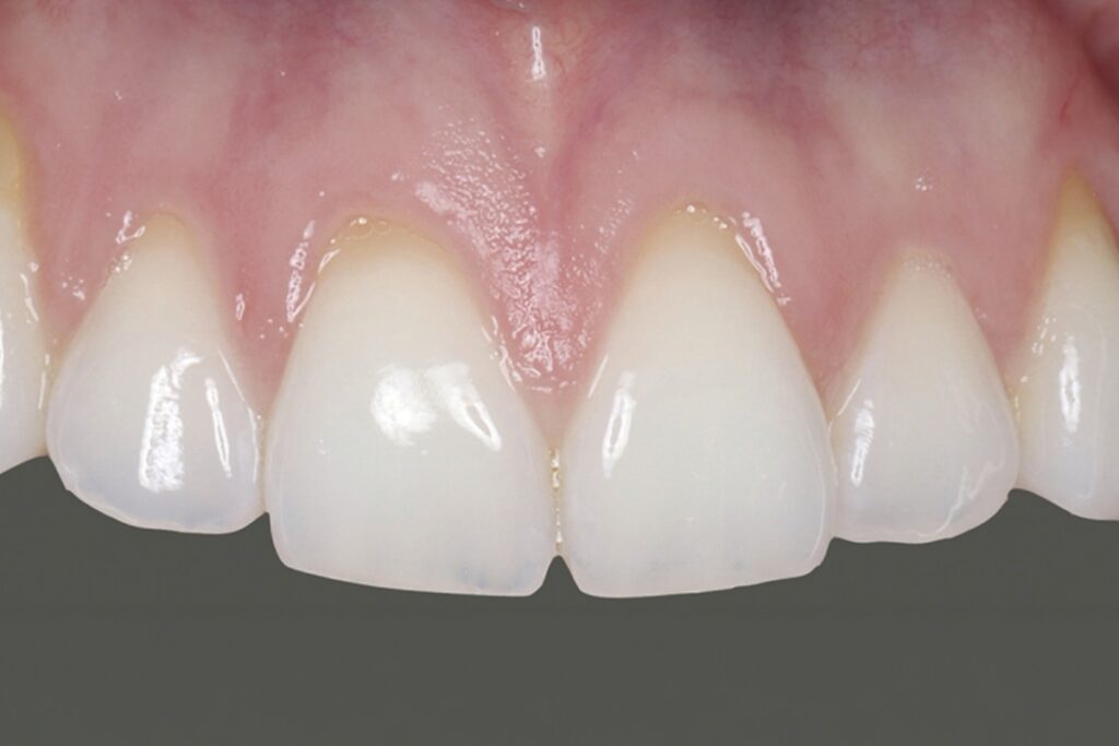 Villaespaceparo_avant